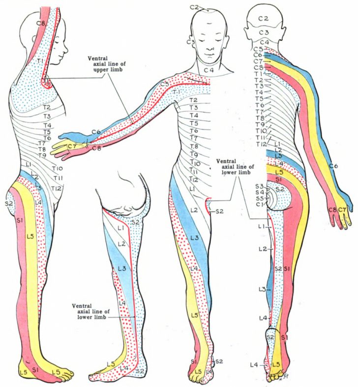 Dermatome Anatomy Wikipedia Printable Dermatome Map Printable Maps Porn Sex Picture